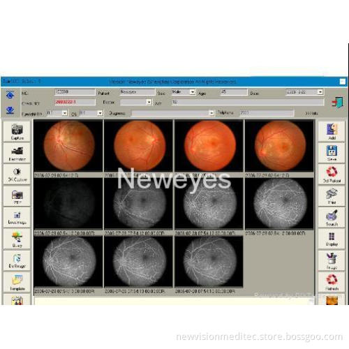 Fundus (retina) Camera Software for Imaging Processing